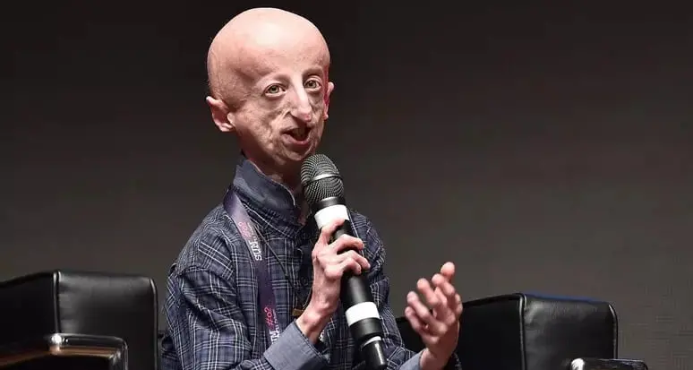 Progeria, aiuto alla ricerca da Pergine: raccolti 8.400 euro per l’associazione Sammy Basso