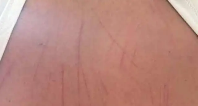 Il drammatico racconto dell'operaio aggredito dall’orso: “Mi sono buttato giù e ho pregato”